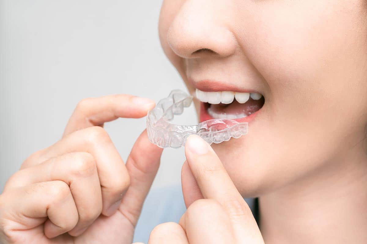Keys to your Retainer Success